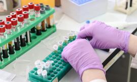Coronavirus Marche, 137 nuovi casi su 572 tamponi analizzati nelle ultime 24 ore: trend stabile